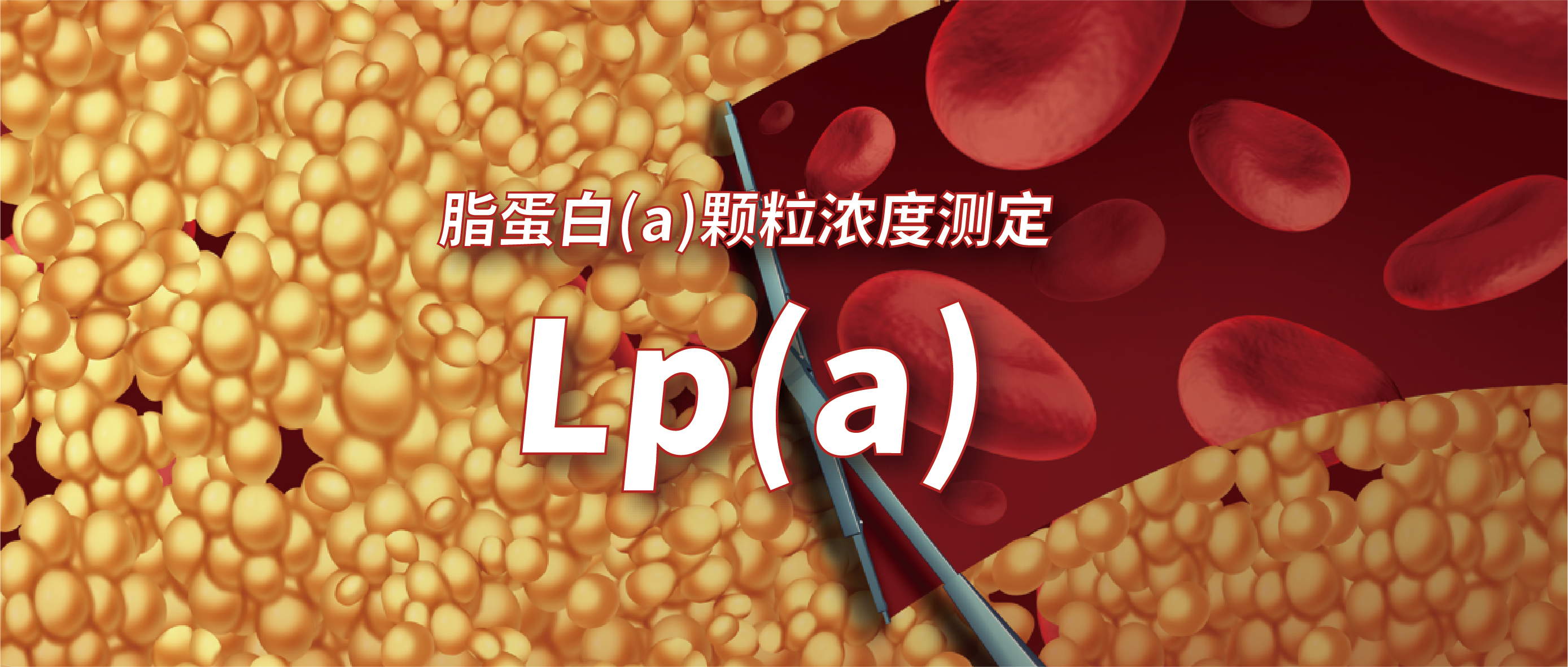 Lp(a)測定如何選擇？質(zhì)量濃度法or顆粒濃度法？